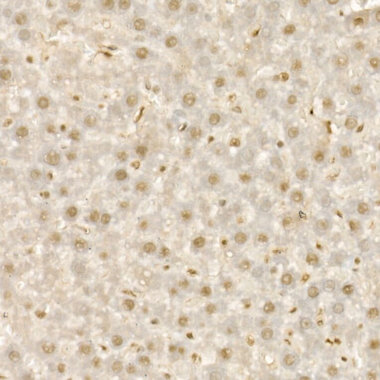 Immunohistochemistry - Anti-KDM1/LSD1 Antibody (A306723) - Antibodies.com