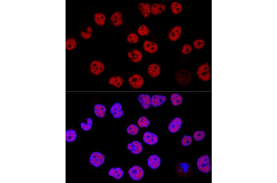 Immunofluorescence - Anti-KDM1/LSD1 Antibody (A306723) - Antibodies.com