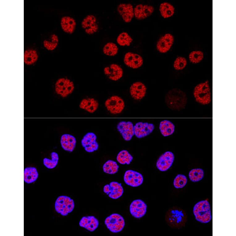 Immunofluorescence - Anti-KDM1/LSD1 Antibody (A306723) - Antibodies.com