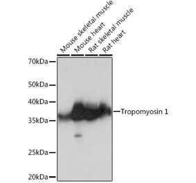 Western Blot - Anti-Tropomyosin 1 (alpha) Antibody [ARC1283] (A306724) - Antibodies.com