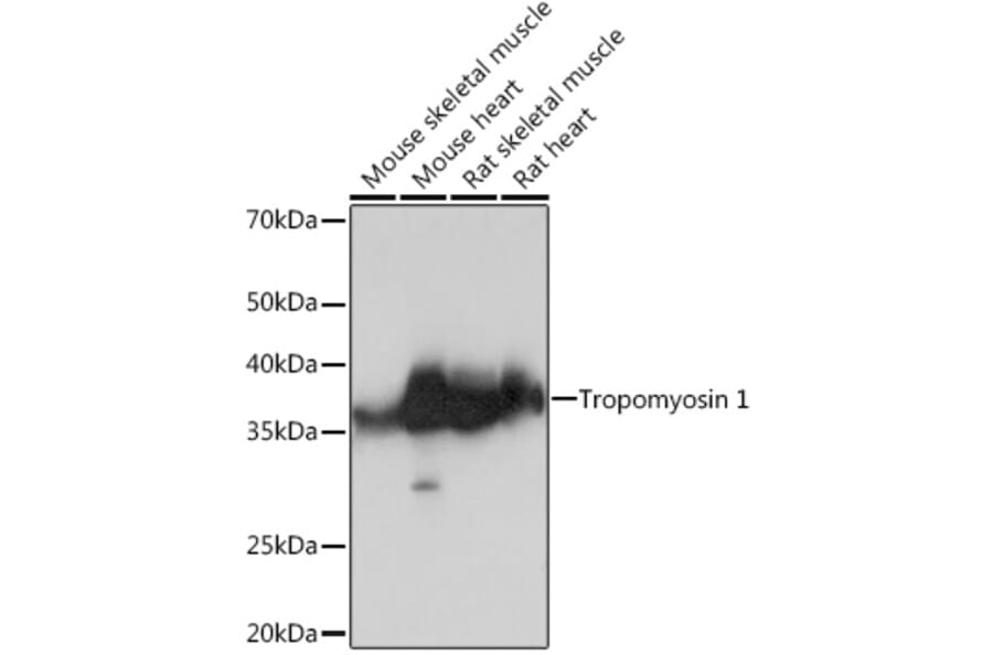 Western Blot - Anti-Tropomyosin 1 (alpha) Antibody [ARC1283] (A306724) - Antibodies.com
