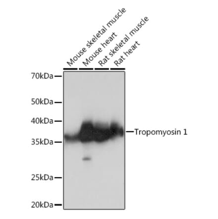 Western Blot - Anti-Tropomyosin 1 (alpha) Antibody [ARC1283] (A306724) - Antibodies.com
