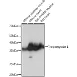 Western Blot - Anti-Tropomyosin 1 (alpha) Antibody [ARC1283] (A306724) - Antibodies.com