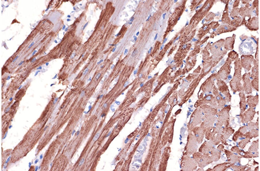 Immunohistochemistry - Anti-Tropomyosin 1 (alpha) Antibody [ARC1283] (A306724) - Antibodies.com