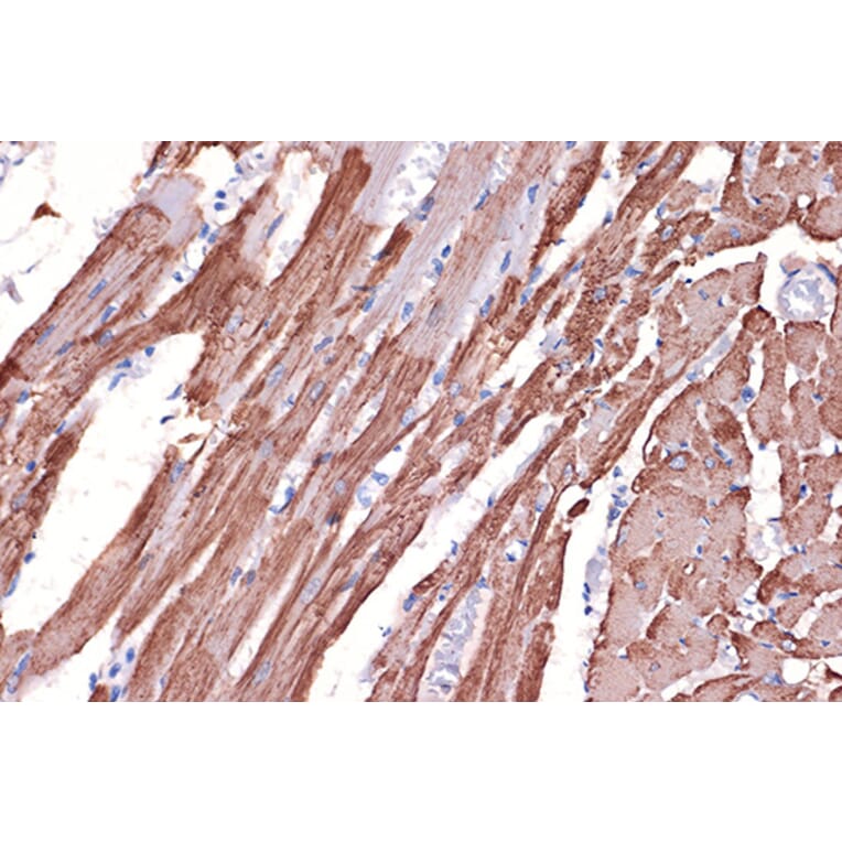 Immunohistochemistry - Anti-Tropomyosin 1 (alpha) Antibody [ARC1283] (A306724) - Antibodies.com