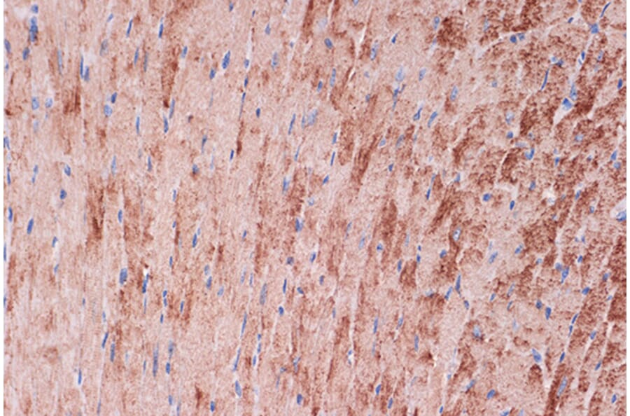 Immunohistochemistry - Anti-Tropomyosin 1 (alpha) Antibody [ARC1283] (A306724) - Antibodies.com