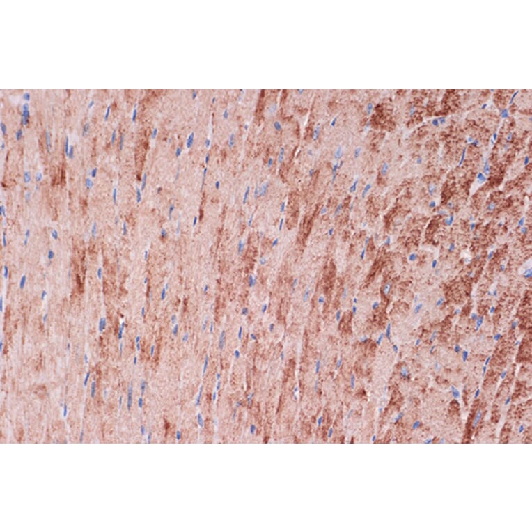 Immunohistochemistry - Anti-Tropomyosin 1 (alpha) Antibody [ARC1283] (A306724) - Antibodies.com