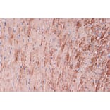 Immunohistochemistry - Anti-Tropomyosin 1 (alpha) Antibody [ARC1283] (A306724) - Antibodies.com