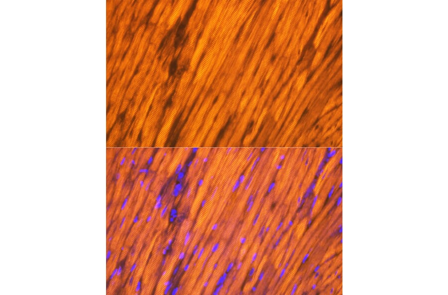 Immunofluorescence - Anti-Tropomyosin 1 (alpha) Antibody [ARC1283] (A306724) - Antibodies.com