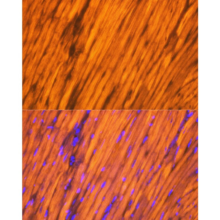 Immunofluorescence - Anti-Tropomyosin 1 (alpha) Antibody [ARC1283] (A306724) - Antibodies.com