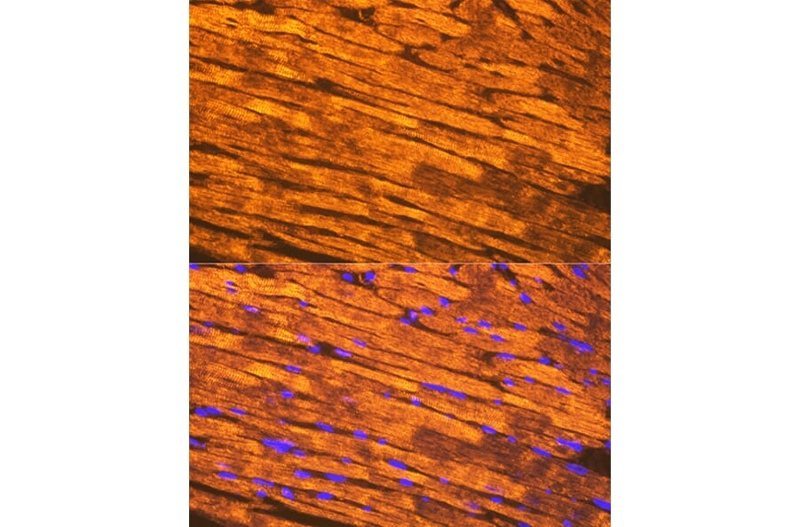 Immunofluorescence - Anti-Tropomyosin 1 (alpha) Antibody [ARC1283] (A306724) - Antibodies.com