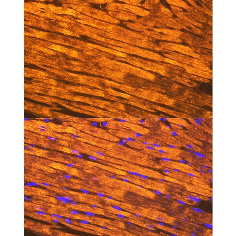 Immunofluorescence - Anti-Tropomyosin 1 (alpha) Antibody [ARC1283] (A306724) - Antibodies.com