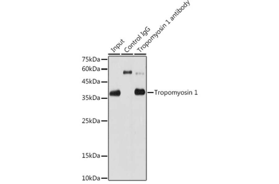 Western Blot - Anti-Tropomyosin 1 (alpha) Antibody [ARC1283] (A306724) - Antibodies.com