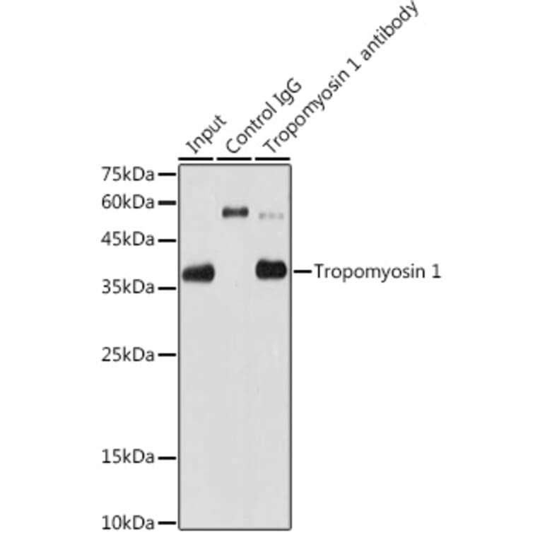 Western Blot - Anti-Tropomyosin 1 (alpha) Antibody [ARC1283] (A306724) - Antibodies.com
