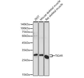 Western Blot - Anti-TIGAR Antibody (A306725) - Antibodies.com