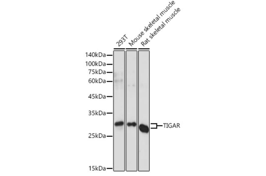 Western Blot - Anti-TIGAR Antibody (A306725) - Antibodies.com