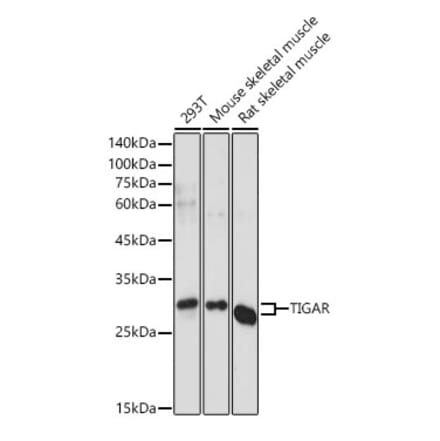 Western Blot - Anti-TIGAR Antibody (A306725) - Antibodies.com