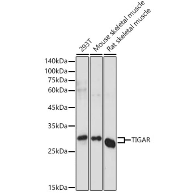 Western Blot - Anti-TIGAR Antibody (A306725) - Antibodies.com