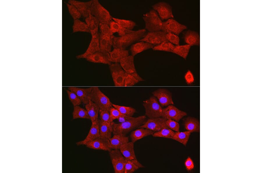 Immunofluorescence - Anti-TIGAR Antibody (A306725) - Antibodies.com