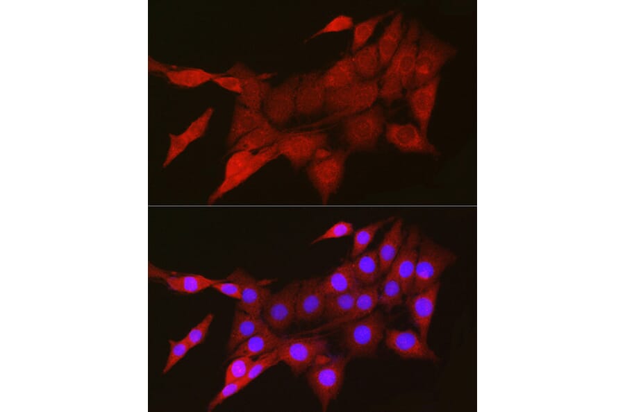 Immunofluorescence - Anti-TIGAR Antibody (A306725) - Antibodies.com