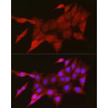 Immunofluorescence - Anti-TIGAR Antibody (A306725) - Antibodies.com