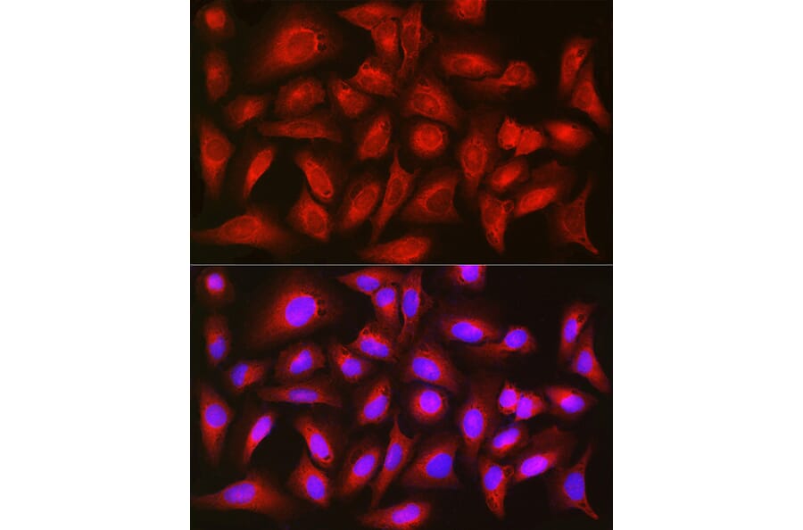 Immunofluorescence - Anti-TIGAR Antibody (A306725) - Antibodies.com