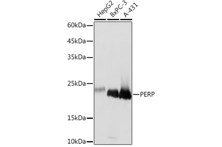 Western Blot - Anti-PERP Antibody [ARC2094] (A306726) - Antibodies.com