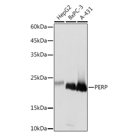 Western Blot - Anti-PERP Antibody [ARC2094] (A306726) - Antibodies.com
