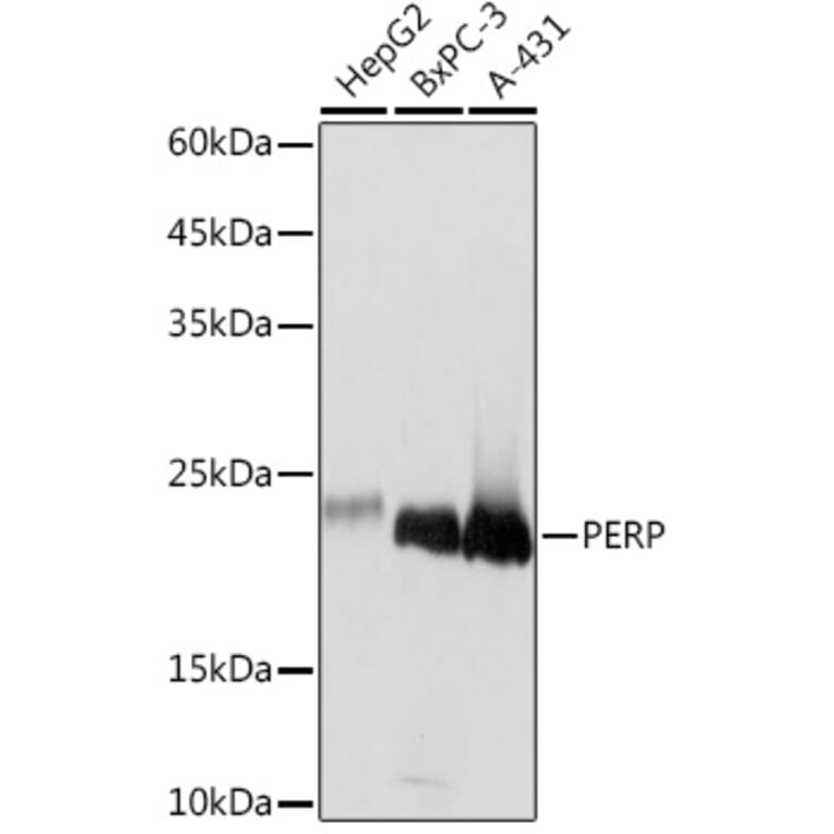 Western Blot - Anti-PERP Antibody [ARC2094] (A306726) - Antibodies.com