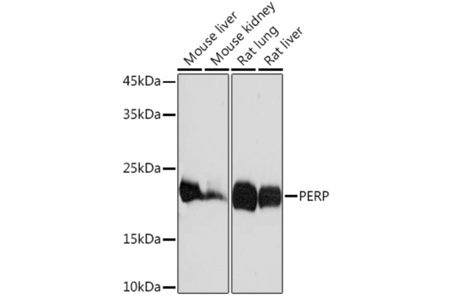 Western Blot - Anti-PERP Antibody [ARC2094] (A306726) - Antibodies.com