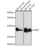 Western Blot - Anti-PERP Antibody [ARC2094] (A306726) - Antibodies.com