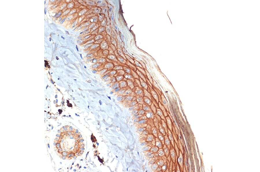 Immunohistochemistry - Anti-PERP Antibody [ARC2094] (A306726) - Antibodies.com