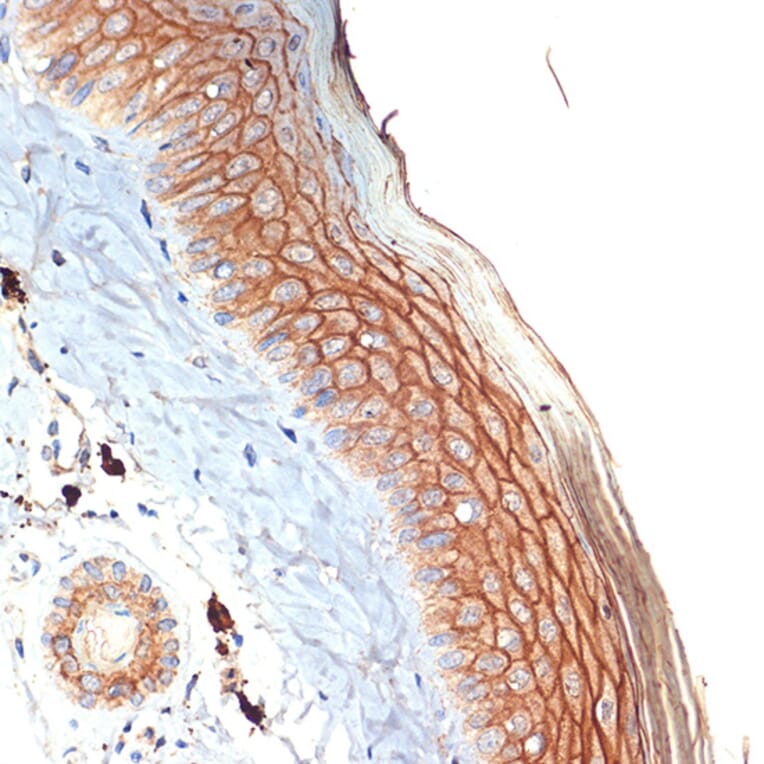 Immunohistochemistry - Anti-PERP Antibody [ARC2094] (A306726) - Antibodies.com