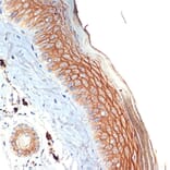 Immunohistochemistry - Anti-PERP Antibody [ARC2094] (A306726) - Antibodies.com