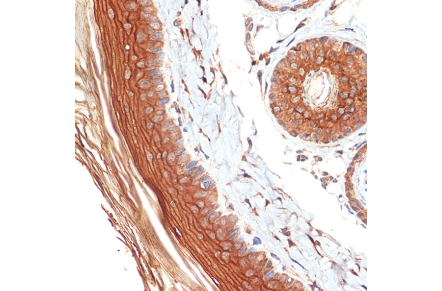 Immunohistochemistry - Anti-PERP Antibody [ARC2094] (A306726) - Antibodies.com