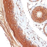 Immunohistochemistry - Anti-PERP Antibody [ARC2094] (A306726) - Antibodies.com