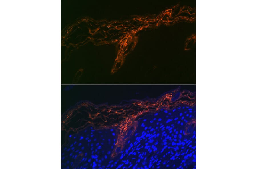 Immunofluorescence - Anti-PERP Antibody [ARC2094] (A306726) - Antibodies.com
