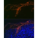 Immunofluorescence - Anti-PERP Antibody [ARC2094] (A306726) - Antibodies.com