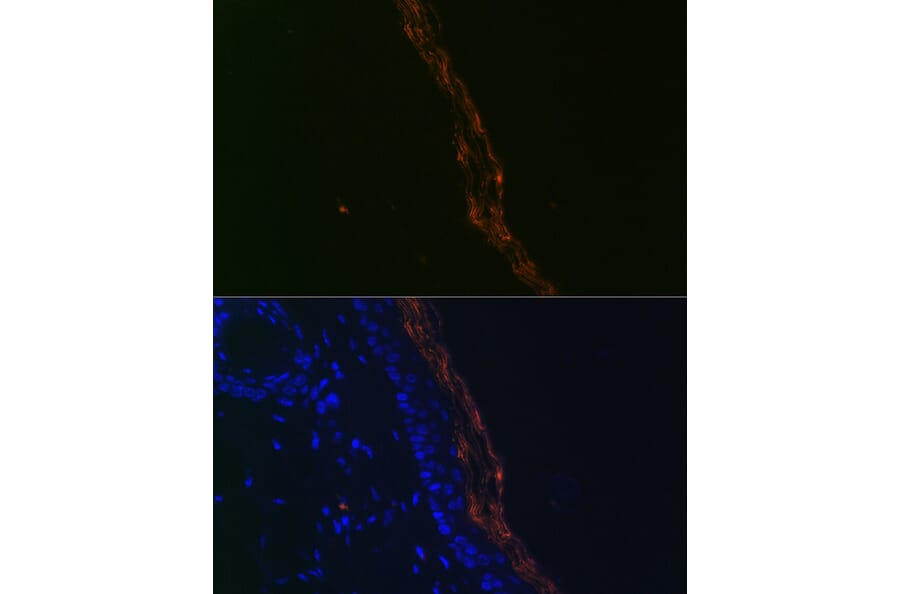 Immunofluorescence - Anti-PERP Antibody [ARC2094] (A306726) - Antibodies.com