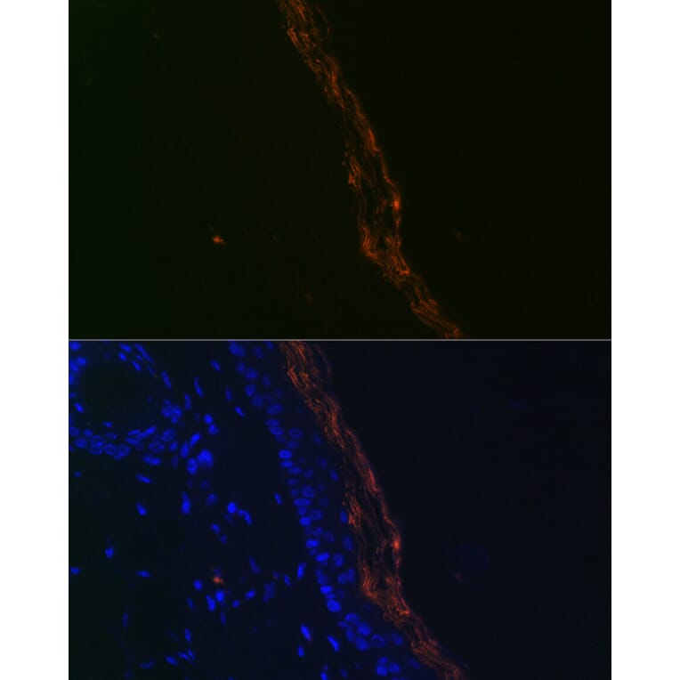 Immunofluorescence - Anti-PERP Antibody [ARC2094] (A306726) - Antibodies.com