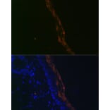 Immunofluorescence - Anti-PERP Antibody [ARC2094] (A306726) - Antibodies.com