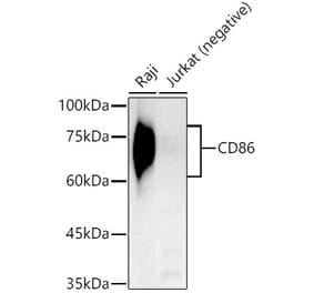 Western Blot - Anti-CD86 Antibody [ARC54011] (A306727) - Antibodies.com