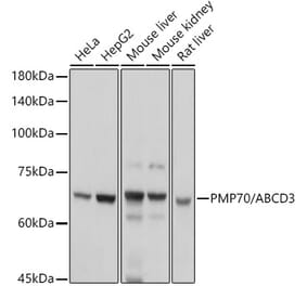 Western Blot - Anti-PMP70 Antibody (A306728) - Antibodies.com