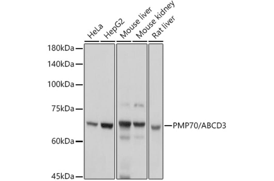 Western Blot - Anti-PMP70 Antibody (A306728) - Antibodies.com