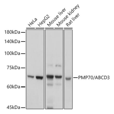 Western Blot - Anti-PMP70 Antibody (A306728) - Antibodies.com