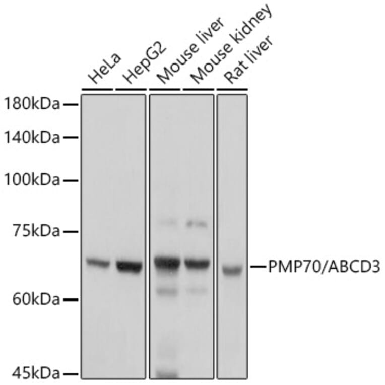 Western Blot - Anti-PMP70 Antibody (A306728) - Antibodies.com