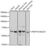 Western Blot - Anti-PMP70 Antibody (A306728) - Antibodies.com