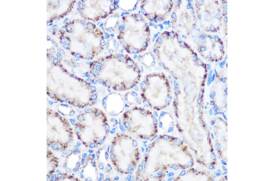 Immunohistochemistry - Anti-PMP70 Antibody (A306728) - Antibodies.com