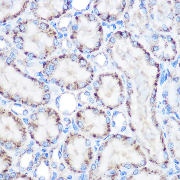 Immunohistochemistry - Anti-PMP70 Antibody (A306728) - Antibodies.com