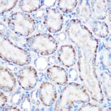 Immunohistochemistry - Anti-PMP70 Antibody (A306728) - Antibodies.com